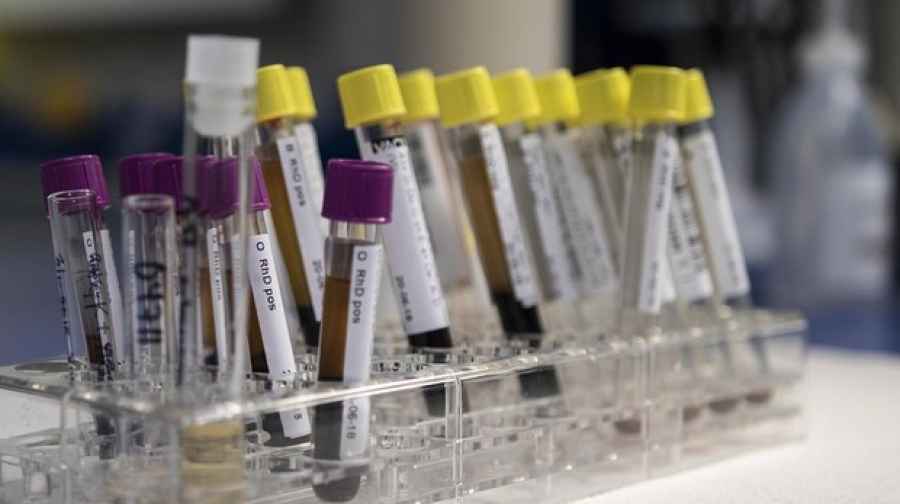 Patolog&iacute;as que predicen el Alzh&eacute;imer 15 a&ntilde;os antes de su aparici&oacute;n