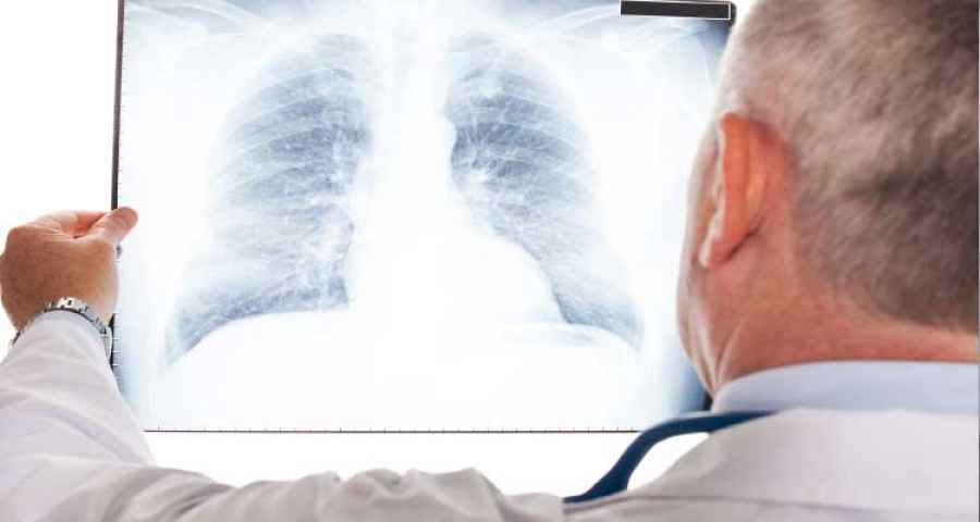 Hay seis millones de personas de m&aacute;s de 65 a&ntilde;os que podr&iacute;an beneficiarse de la vacuna, pero la cobertura es muy baja; la Sociedad Argentina de Infectolog&iacute;a lanz&oacute; una campa&ntilde;a