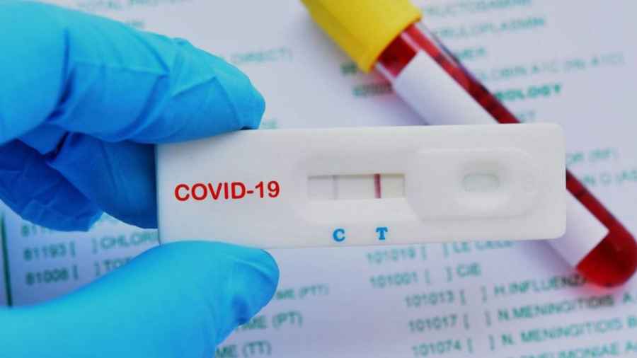 Anmat autorizar&iacute;a los test de autodiagn&oacute;stico de Covid-19