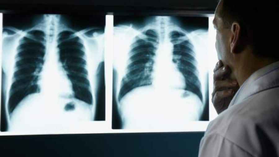 #M&aacute;sAireEnTusPulmones: una iniciativa para generar conciencia