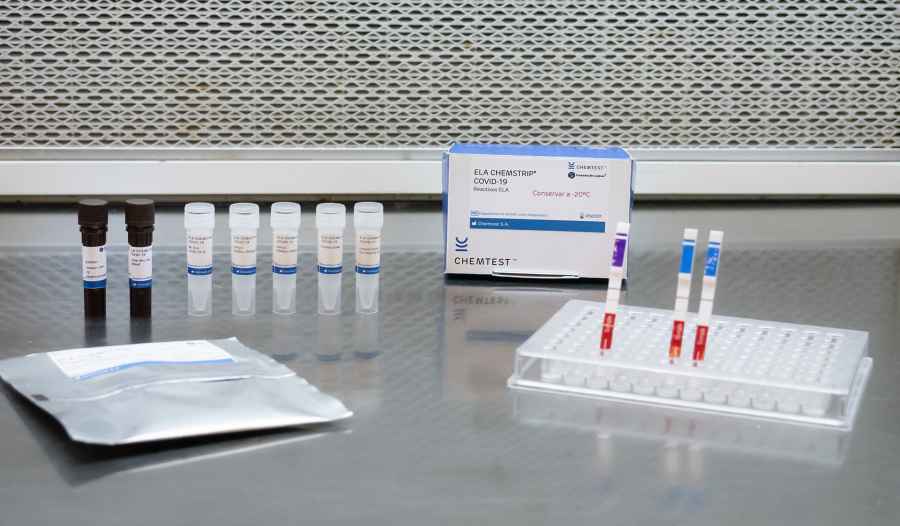 Anmat aprob&oacute; dos nuevos test para Covid-19