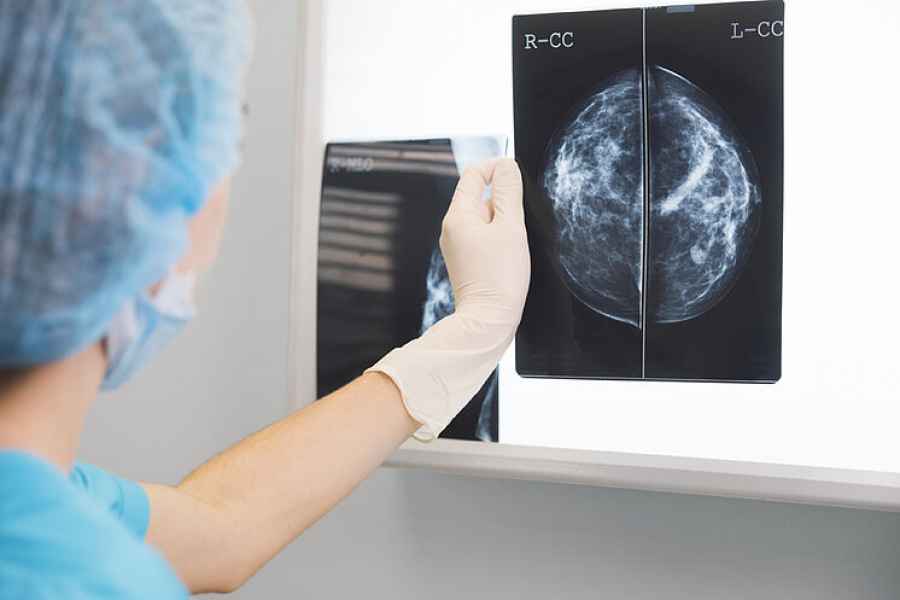 Las pacientes con cáncer de mama operable con receptor hormonal positivo de alto riesgo pueden evitar recidivas con un nuevo tratamiento.