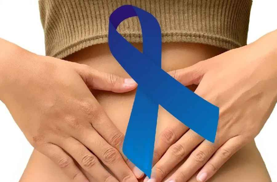 C&aacute;ncer de colon: tumor altamente prevenible