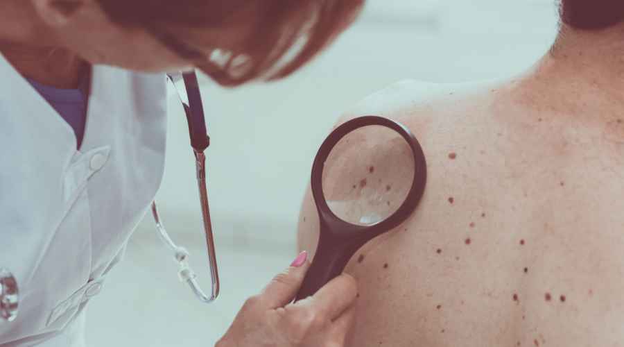 Es fundamental incorporar la premisa de cuidad la piel en cualquier &eacute;poca del a&ntilde;o y realizar un chequeo de control anual a&uacute;n en pandemia.