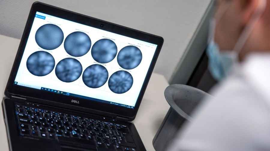 Vacuna experimental extiende 5 a&ntilde;os vida de mujeres con c&aacute;ncer de mama