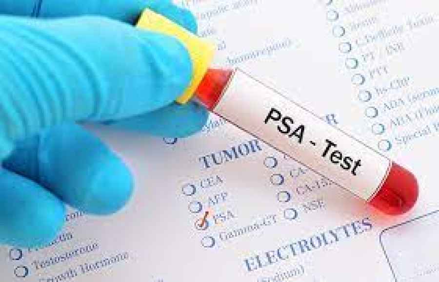 La importancia de la detecci&oacute;n temprana en el c&aacute;ncer de pr&oacute;stata