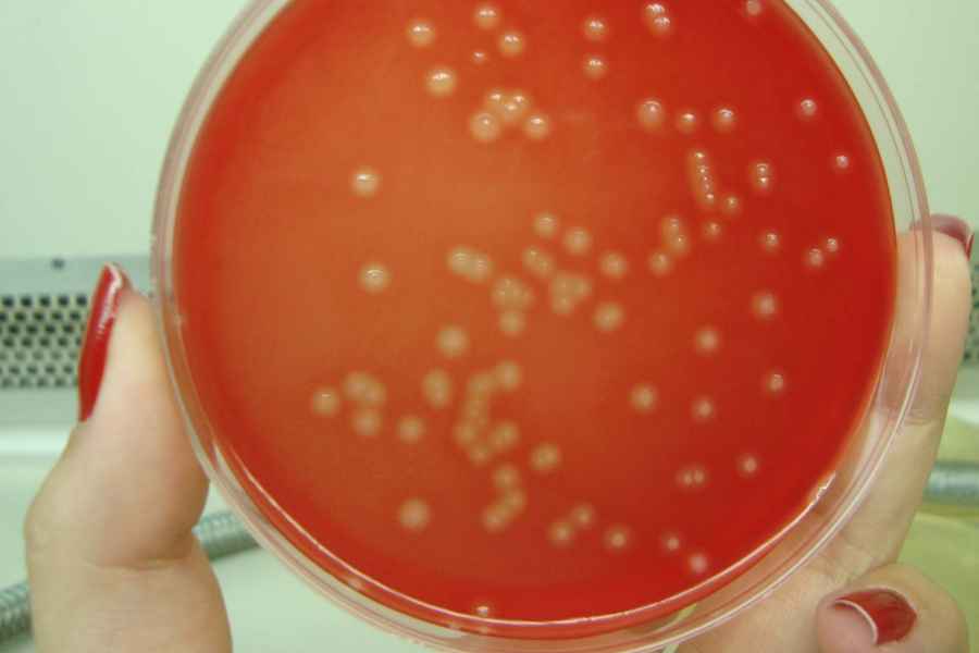 Vacuna que trata y previene el shock t&oacute;xico mortal causado por estreptococos