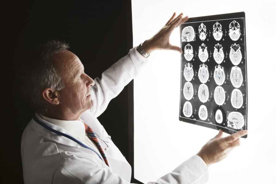 Los casos de demencia en Am&eacute;rica Latina  se cuadruplicar&aacute;n en 2050