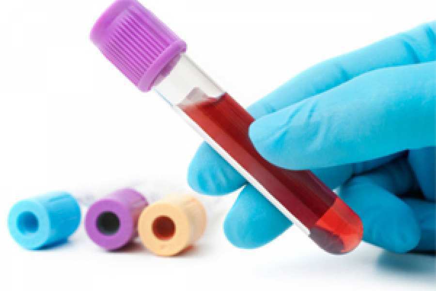 La medici&oacute;n de los niveles de magnesio a partir de un simple an&aacute;lisis de sangre podr&iacute;a ayudar a identificar a las personas en riesgo de padecer demencia