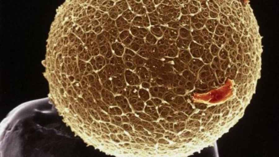 Los investigadores han descrito, en una familia afectada de insuficiencia ov&aacute;rica primaria, una variante del gen HSF2BP como responsable causal de dicha enfermedad.