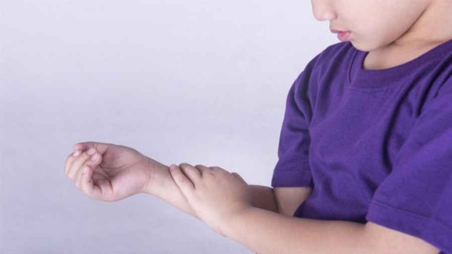Artritis en ni&ntilde;os y adolescentes