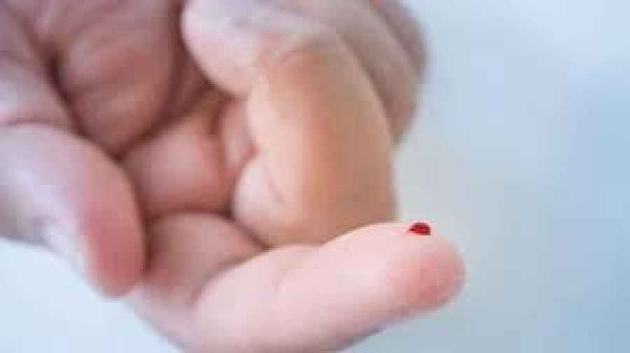 Ya est&aacute; disponible en Argentina un nuevo tratamiento para la hemofilia A