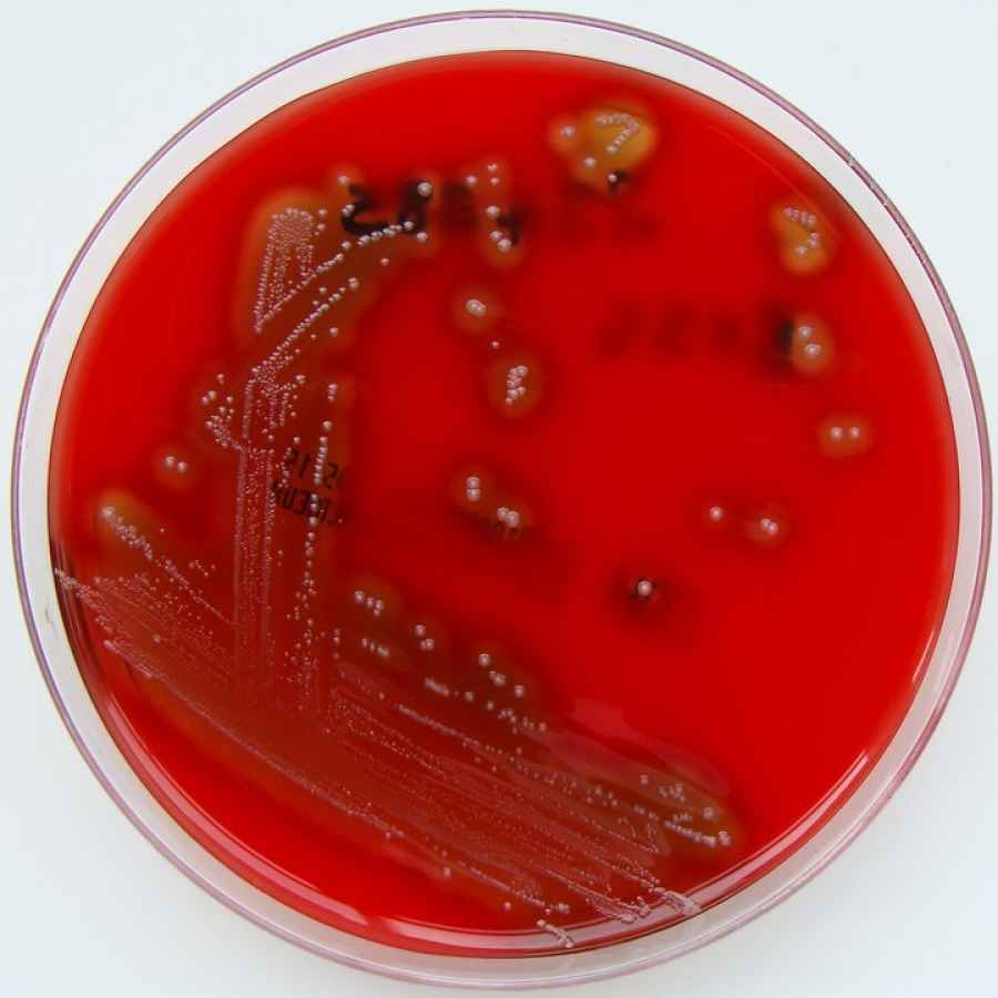 Streptococcus pyogenes. Una imagen de la bacteria que afect&oacute; a cinco chicos