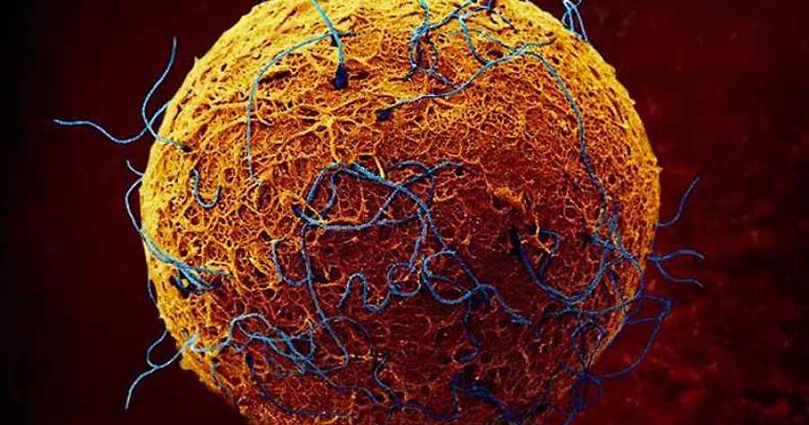 La melatonina puede ayudar a aumentar el &eacute;xito de los transplantes de m&eacute;dula