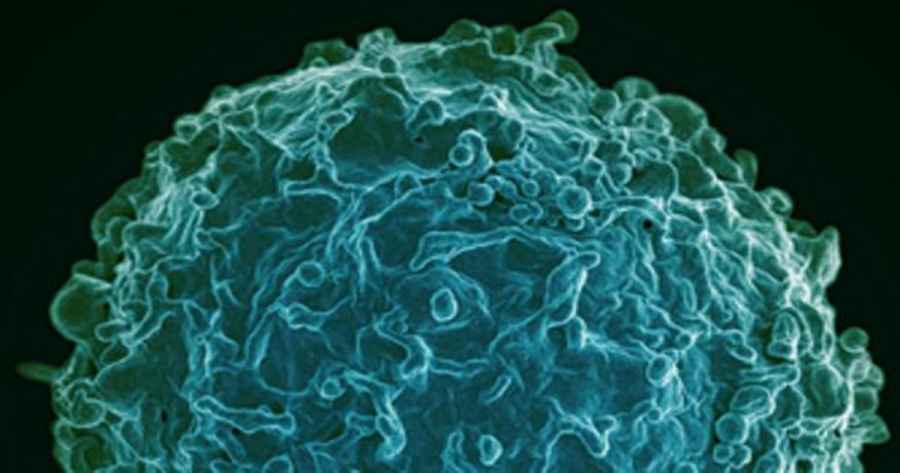 Un estudio publicado en &laquo;PLoS Pathogens&raquo; apuesta por el uso de c&oacute;cteles de anticuerpos en entornos cl&iacute;nicos como un medio &uacute;til para prevenir y tratar la covid-19.