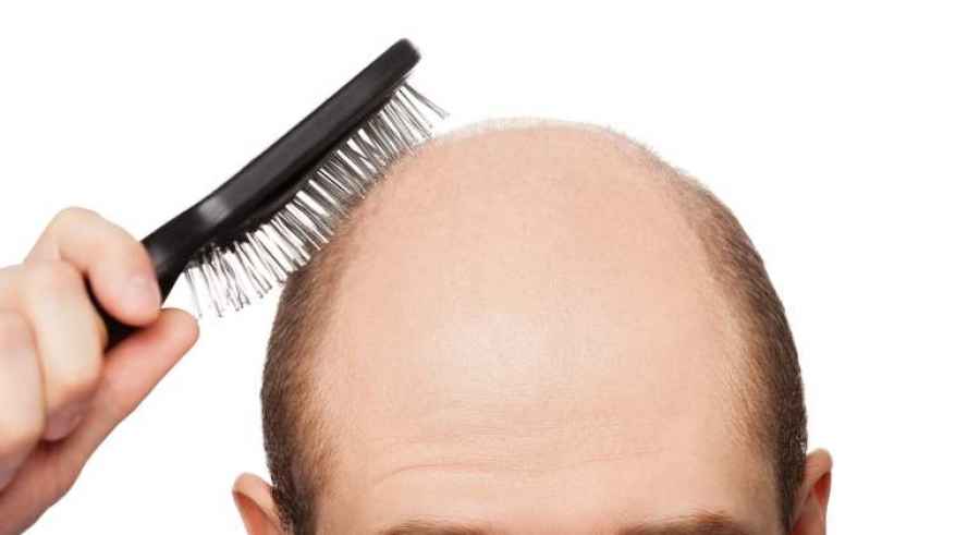 Un f&aacute;rmaco para el eccema, prometedor contra la alopecia