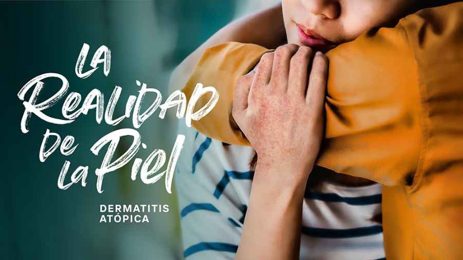 Pfizer Argentina lanz&oacute; la campa&ntilde;a &ldquo;La realidad de la piel&rdquo;